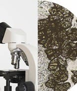 Análise microscópica